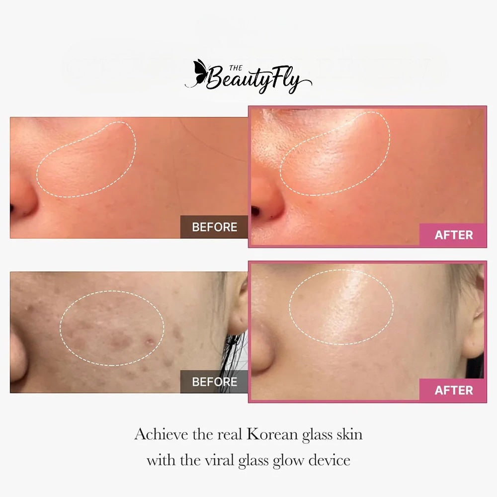BEAUTYFLY SKIN BOOSTER DEVICE